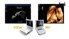Philips CX30 portable ultrasound system review & comparison
