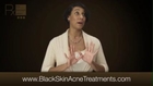 acne products african americans - RX for Brown Skin